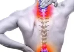 Spinal-cord-injury-1024x734
